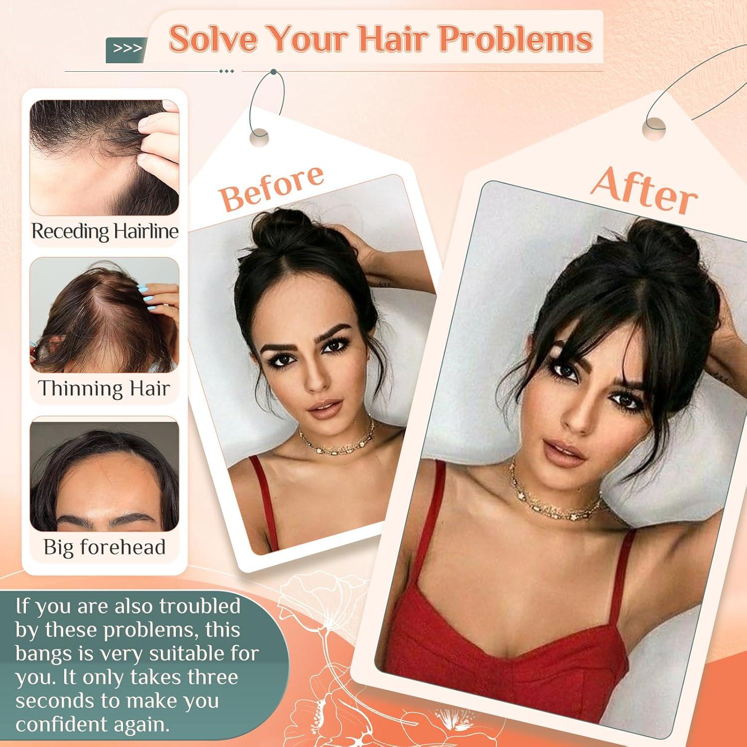 image:imageBenehair Topper de Vrais Cheveux pour Femme 100 Humain Chevelure Frange Latrale 9g Toppers pour aux Cheveux Fins 5x12 Base de Dentelle Vrais Chevelure Pince Brun Moka 2RBrun Clair 6